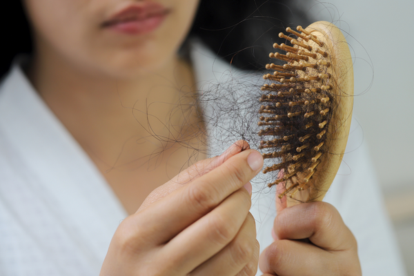 hair loss