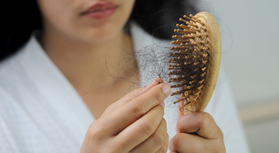 hair loss